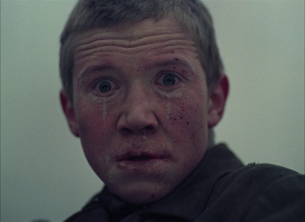 Traumatized boy staring into camera.